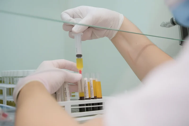 Preparation of platelet-rich plasma (PRP) for knee treatment, showing a syringe extracting plasma from blood samples in a clinical laboratory.